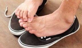Itching as a cause of mushrooms