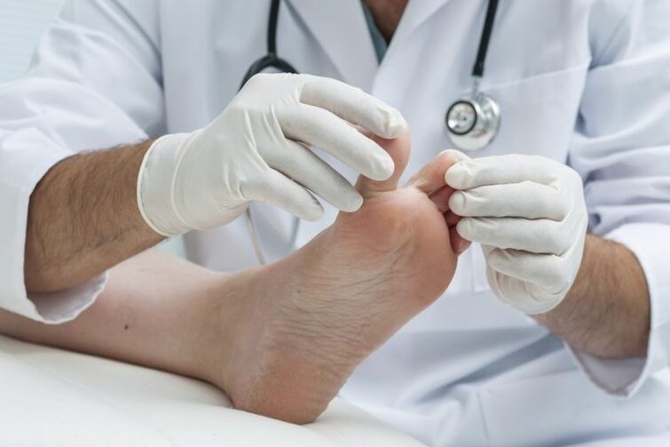 The examination of the doctor by the presence of mycosis