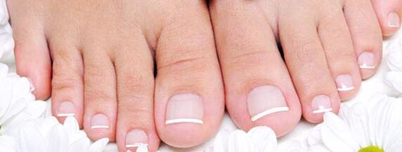 What is the nail fungus