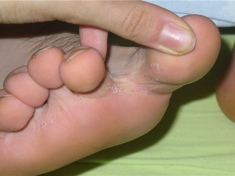Mushroom between the fingers