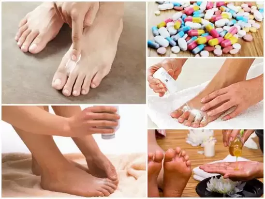 ways to treat fungus between toes